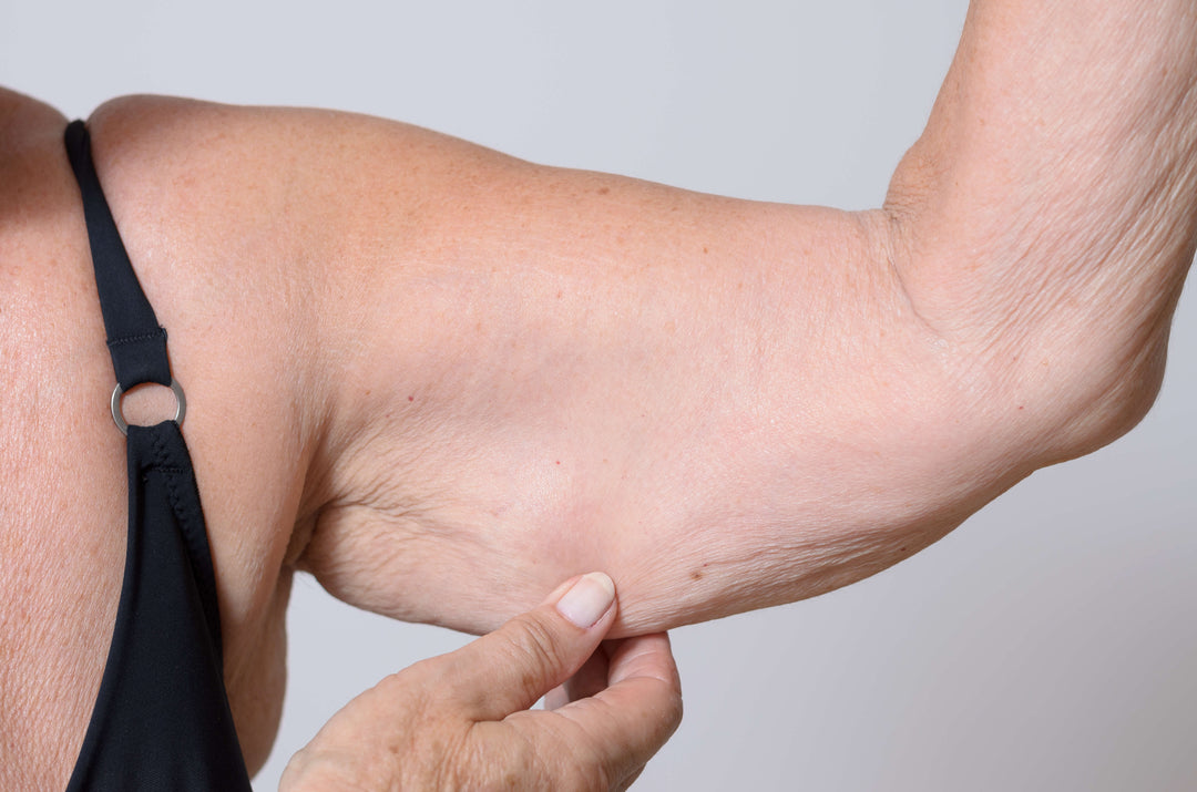 The Long Term Impact of Sarcopenia