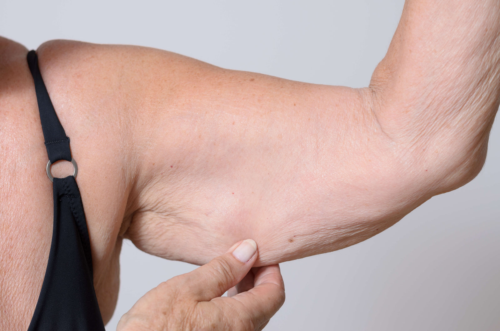 The Long Term Impact of Sarcopenia